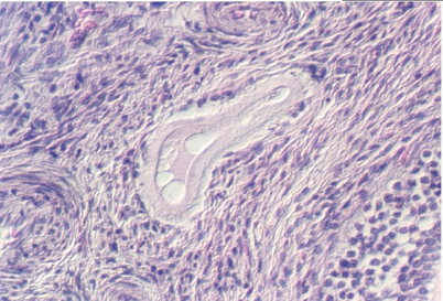 atretic.jpg (99982 bytes)