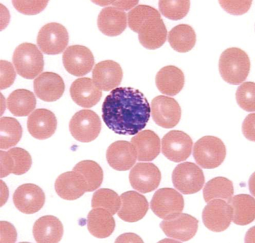 basophil3.JPG (40518 bytes)