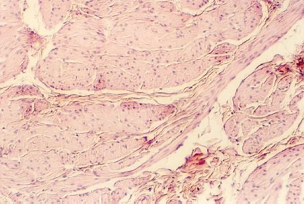 bladder3.jpg (69399 bytes)