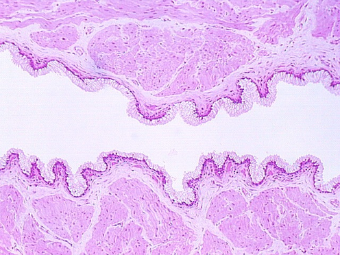 cervix4.jpg (135931 bytes)