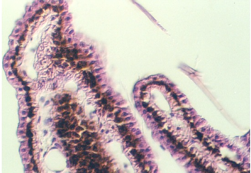 ciliary2.jpg (68047 bytes)