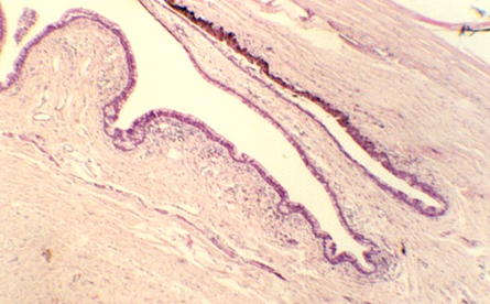 conjunctiva1.jpg (67035 bytes)