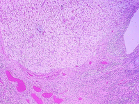 corpus_luteum.jpg (205957 bytes)