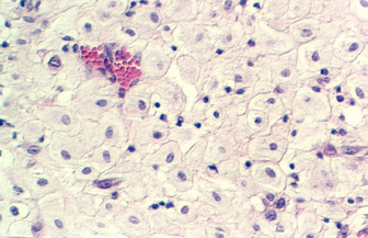 decidua2.jpg (80318 bytes)