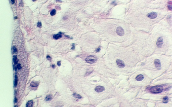 decidua3.jpg (60561 bytes)