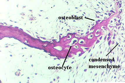 devbone7.jpg (43683 bytes)