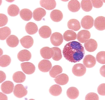 eosinophil1a.JPG (38001 bytes)