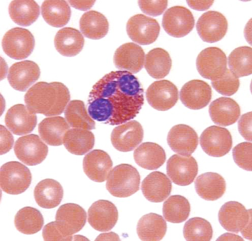 eosinophil6.JPG (46633 bytes)