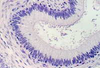 epididymus3.jpg (327223 bytes)