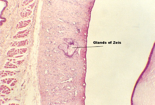 eyelid1.jpg (79134 bytes)