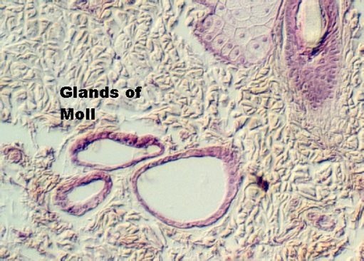 eyelid5.jpg (102688 bytes)