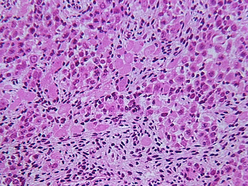 fetal_ovary.jpg (160795 bytes)