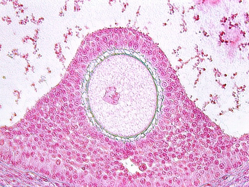 ovary3.jpg (153323 bytes)
