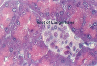 pancreas2.jpg (69626 bytes)