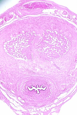 penis4.jpg (65487 bytes)