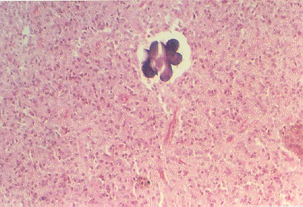 pineal1.jpg (73059 bytes)