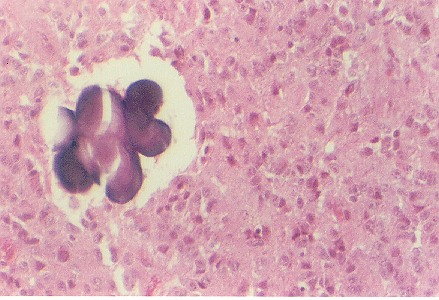 pineal2.jpg (57960 bytes)