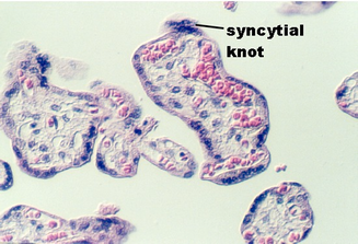placenta_old4.jpg (72696 bytes)