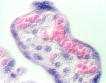 placenta_old8.jpg (64689 bytes)