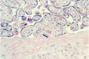 placenta_old.jpg (71791 bytes)