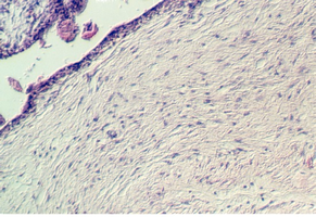 placenta_young1.jpg (102183 bytes)