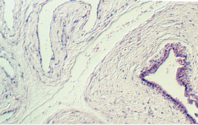 placenta_young2.jpg (78512 bytes)