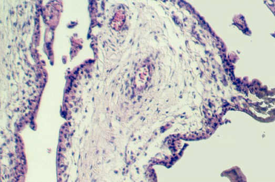 placenta_young3.jpg (74339 bytes)