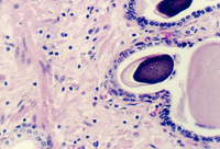 prostate1.jpg (282636 bytes)