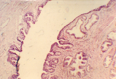 prostate3.jpg (281279 bytes)