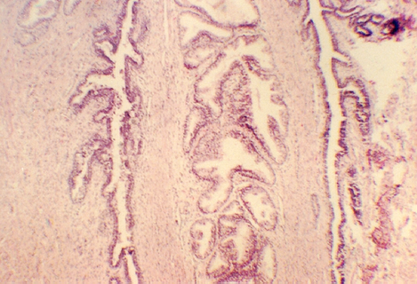 prostate4.jpg (292054 bytes)