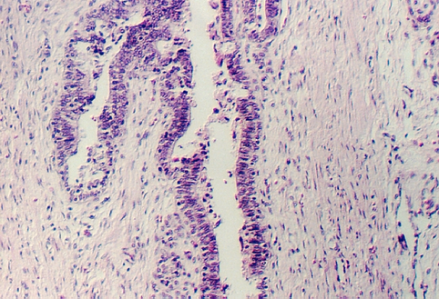 prostate5.jpg (349243 bytes)