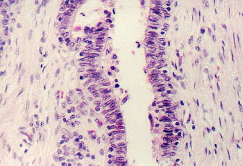 prostate6.jpg (295725 bytes)