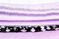 retina1.jpg (72400 bytes)