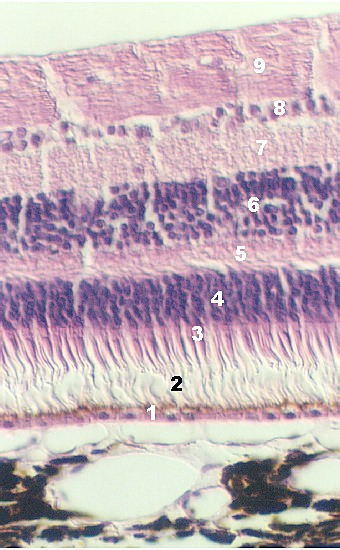 retina3.jpg (78835 bytes)