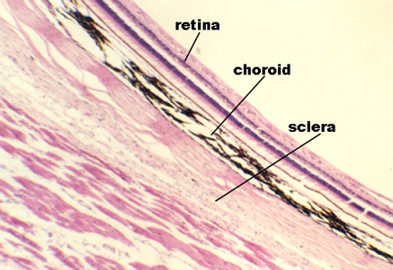 retina4.jpg (75807 bytes)