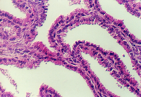 seminalv2.jpg (335523 bytes)