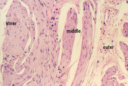 ureter2.jpg (108783 bytes)