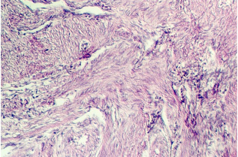 uterus7.jpg (111465 bytes)