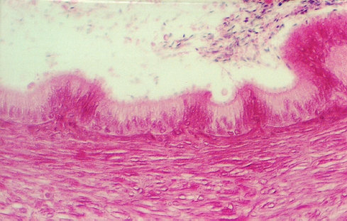 vas_deferens1.jpg (281706 bytes) 