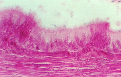 vas_deferens2.jpg (278392 bytes)
