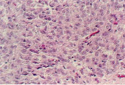 ypineal1.jpg (83269 bytes)