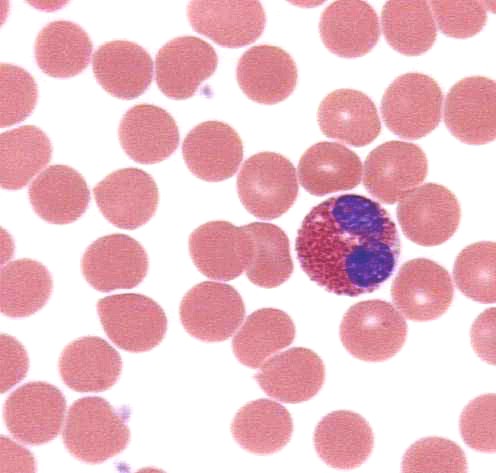 eosinophil1a.JPG (38001 bytes)