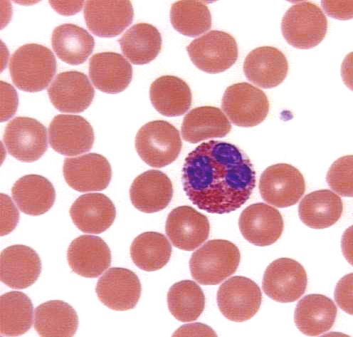eosinophil3.JPG (41989 bytes)
