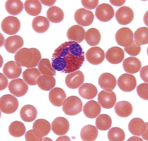 eosinophil6.JPG (46633 bytes)