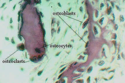 devbone8.jpg (29538 bytes)