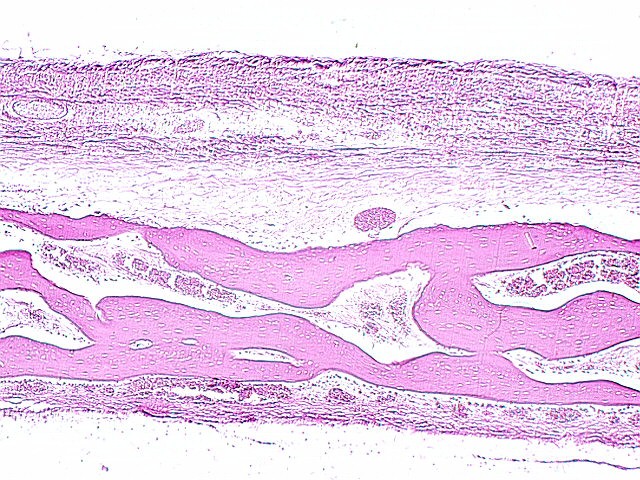 fetal_skull.jpg (162672 bytes)