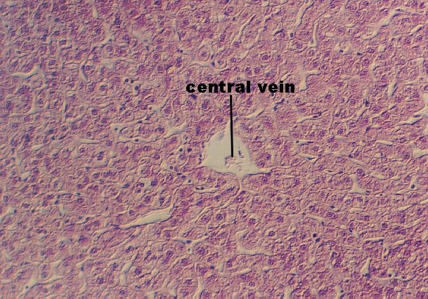 liver1.jpg (386477 bytes)