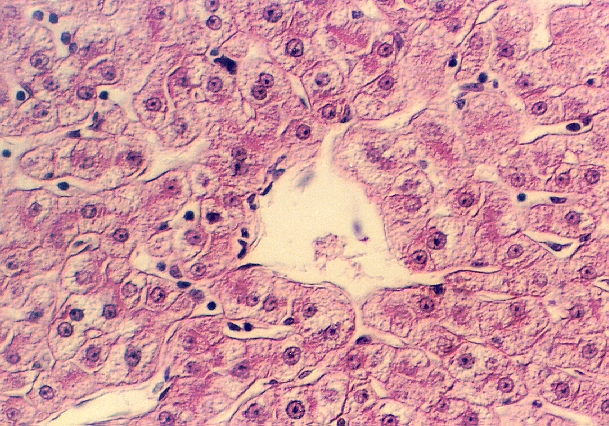 liver2.jpg (369253 bytes)