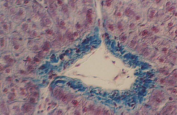 liver3.jpg (258876 bytes)