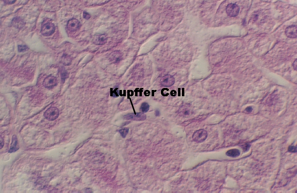 liver6.jpg (237334 bytes)